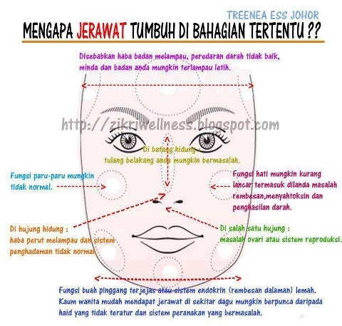 Jerawat: Cara Pantas Hilangkan untuk Kulit Bebas Cela