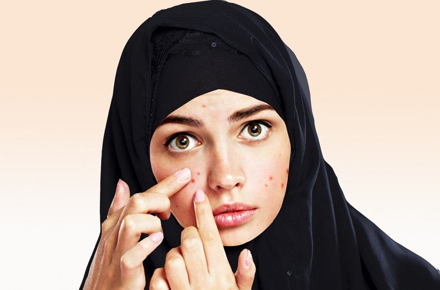 Jerawat: 11 Cara untuk Hasil Terbaik